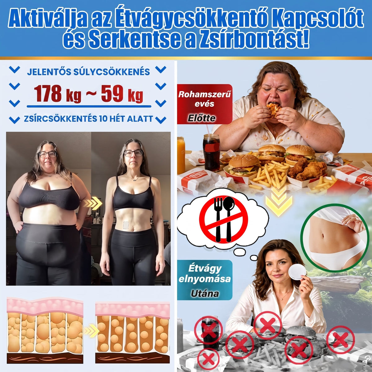 FFBSI® Nano mikrotűs karcsúsító tapasz (Naponta egyszer már 28 napon belül látható változások láthatók) Alkalmas: elhízás kezelésére, szív- és érrendszeri egészségre, cukorbetegség kezelésére, alvási apnoéra és bélrendszeri problémákra🔥