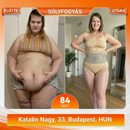 👙HU👙Hivatalos Márkabolt | ZUWIAY® 2026 Moringa & Berberine 4-in-1 Mikrorészecskés Alakformáló és Zsírégető Rövidnadrág（副本）