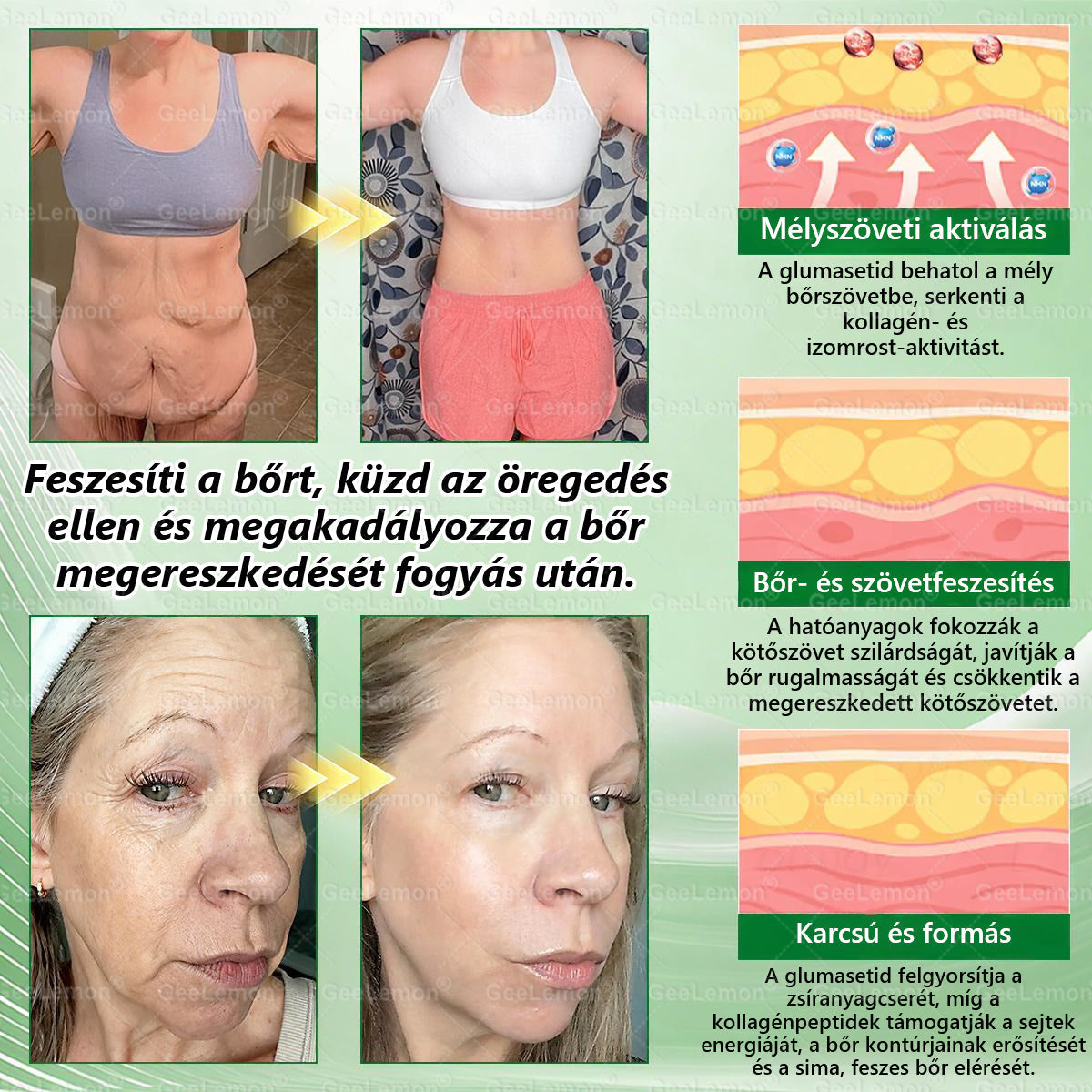 🎉| 🎁 𝐆𝐞𝑒𝐿𝑒𝐦𝐨𝐧® Nano mikrotűs karcsúsító tapasz (Naponta egyszer már 28 napon belül látható változások láthatók) Alkalmas: elhízás kezelésére, szív- és érrendszeri egészségre, cukorbetegség kezelésére, alvási apnoéra és bélrendszeri problémákra🔥