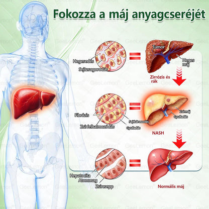 🎉| 🎁 𝐆𝐞𝑒𝐿𝑒𝐦𝐨𝐧® Nano mikrotűs karcsúsító tapasz (Naponta egyszer már 28 napon belül látható változások láthatók) Alkalmas: elhízás kezelésére, szív- és érrendszeri egészségre, cukorbetegség kezelésére, alvási apnoéra és bélrendszeri problémákra🔥