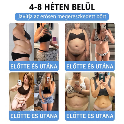 FFBSI® Nano mikrotűs karcsúsító tapasz (Naponta egyszer már 28 napon belül látható változások láthatók) Alkalmas: elhízás kezelésére, szív- és érrendszeri egészségre, cukorbetegség kezelésére, alvási apnoéra és bélrendszeri problémákra🔥