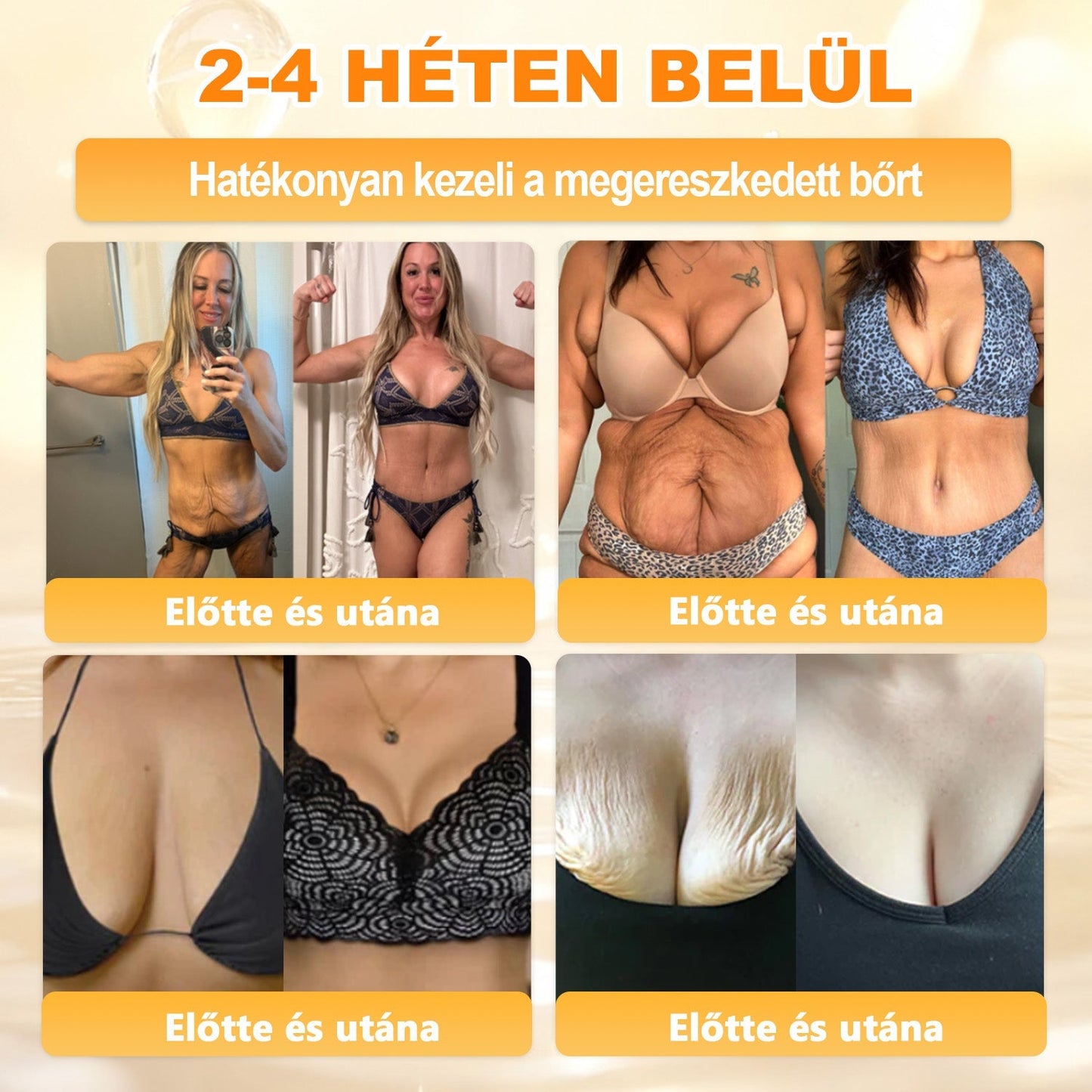 🔥 APKAPK® Méhméreg Bőr Helyreállító Krém 🔥 Magyar fejlesztés, magyarországi gyártás és szállítás