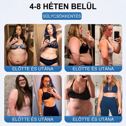 FFBSI® Nano mikrotűs karcsúsító tapasz (Naponta egyszer már 28 napon belül látható változások láthatók) Alkalmas: elhízás kezelésére, szív- és érrendszeri egészségre, cukorbetegség kezelésére, alvási apnoéra és bélrendszeri problémákra🔥