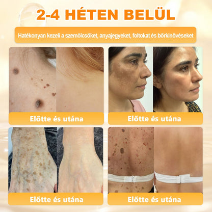 🔥 APKAPK® Méhméreg Bőr Helyreállító Krém 🔥 Magyar fejlesztés, magyarországi gyártás és szállítás