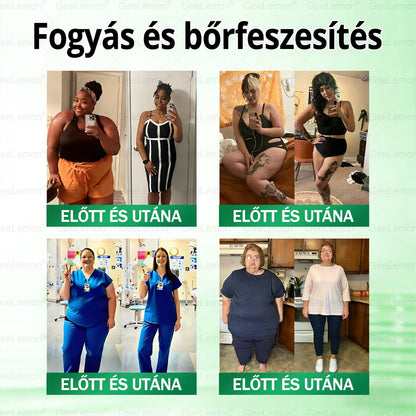 🎉| 🎁 𝐆𝐞𝑒𝐿𝑒𝐦𝐨𝐧® Nano mikrotűs karcsúsító tapasz (Naponta egyszer már 28 napon belül látható változások láthatók) Alkalmas: elhízás kezelésére, szív- és érrendszeri egészségre, cukorbetegség kezelésére, alvási apnoéra és bélrendszeri problémákra🔥