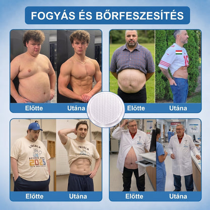 FFBSI® Nano mikrotűs karcsúsító tapasz (Naponta egyszer már 28 napon belül látható változások láthatók) Alkalmas: elhízás kezelésére, szív- és érrendszeri egészségre, cukorbetegség kezelésére, alvási apnoéra és bélrendszeri problémákra🔥