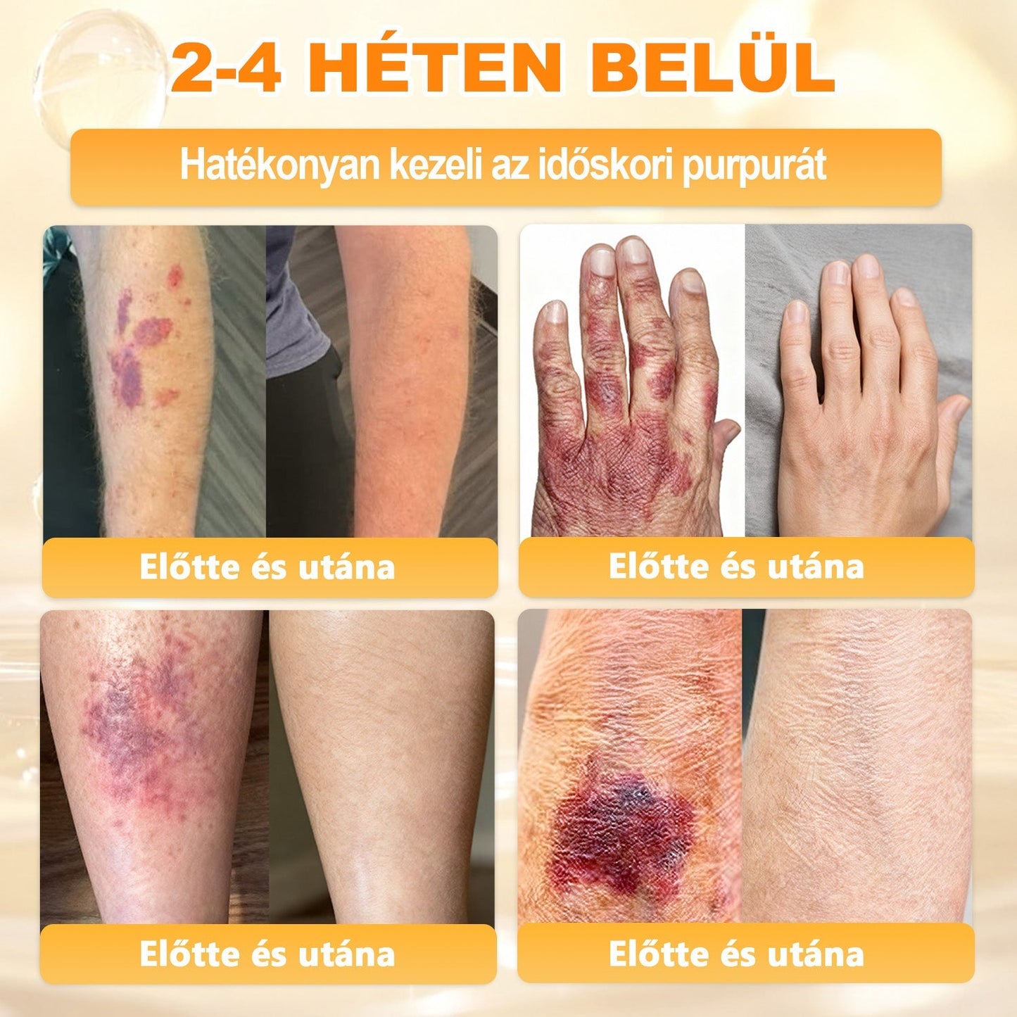 🔥 APKAPK® Méhméreg Bőr Helyreállító Krém 🔥 Magyar fejlesztés, magyarországi gyártás és szállítás