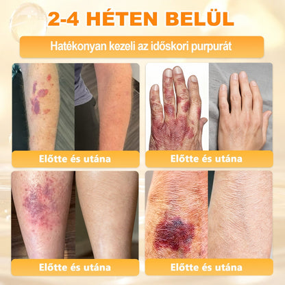 🔥 APKAPK® Méhméreg Bőr Helyreállító Krém 🔥 Magyar fejlesztés, magyarországi gyártás és szállítás