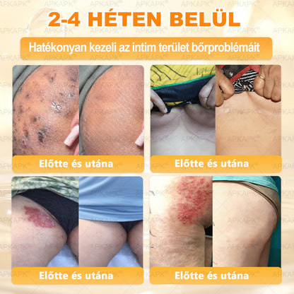 🔥 APKAPK® Méhméreg Bőr Helyreállító Krém 🔥 Magyar fejlesztés, magyarországi gyártás és szállítás