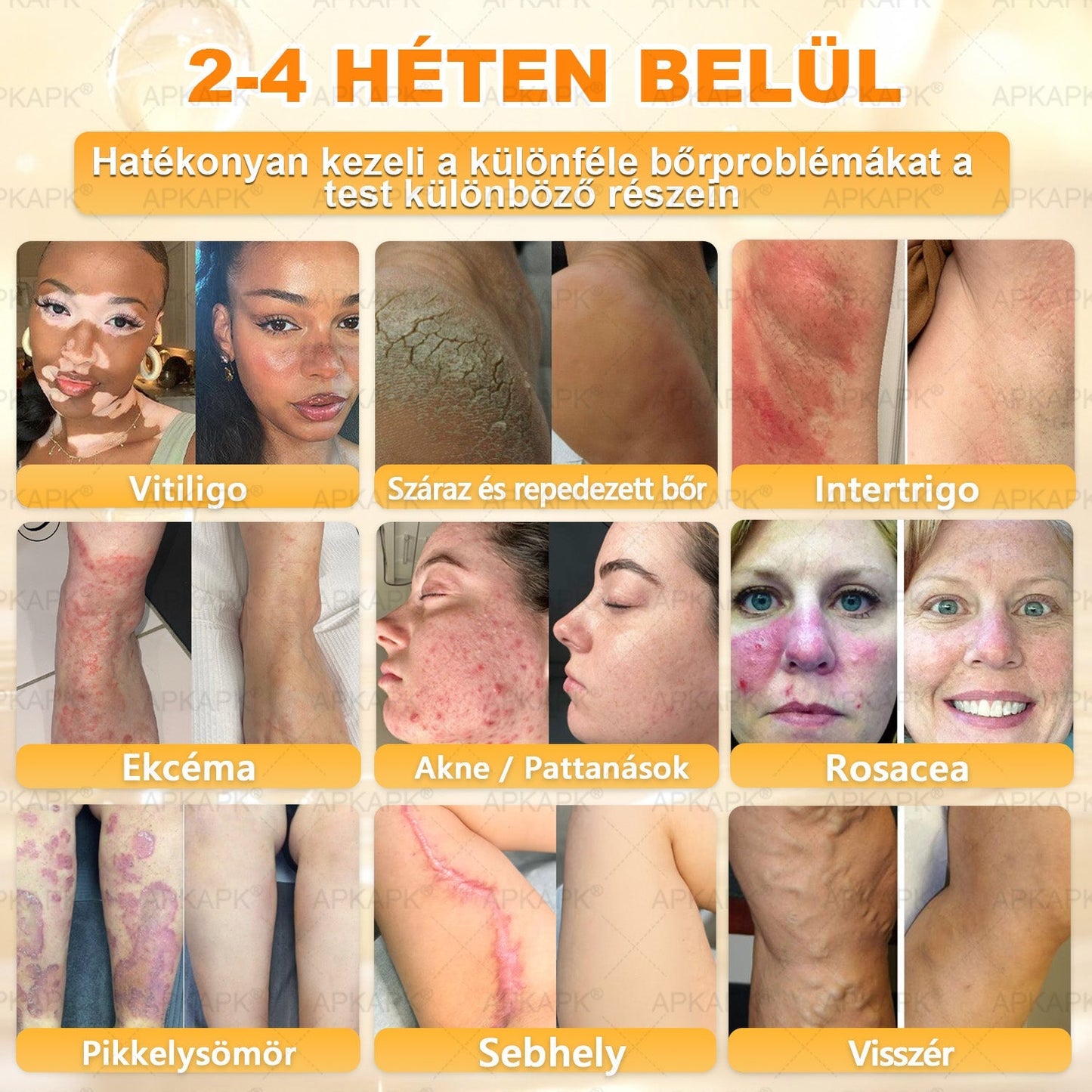 🔥 APKAPK® Méhméreg Bőr Helyreállító Krém 🔥 Magyar fejlesztés, magyarországi gyártás és szállítás