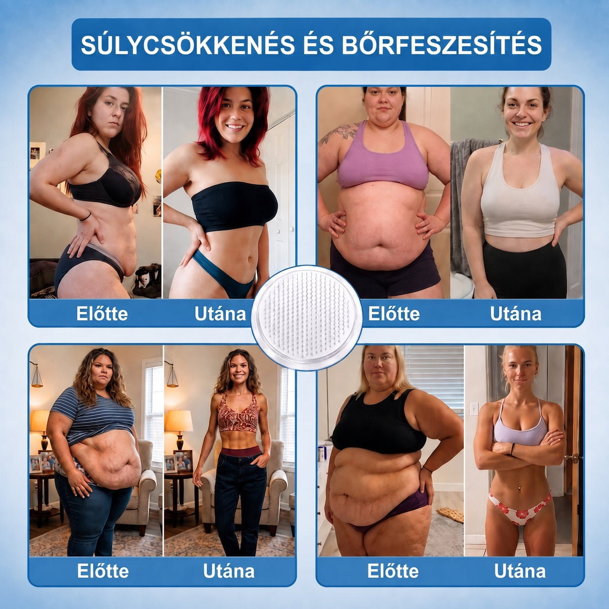 FFBSI® Nano mikrotűs karcsúsító tapasz (Naponta egyszer már 28 napon belül látható változások láthatók) Alkalmas: elhízás kezelésére, szív- és érrendszeri egészségre, cukorbetegség kezelésére, alvási apnoéra és bélrendszeri problémákra🔥