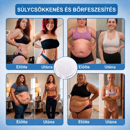 FFBSI® Nano mikrotűs karcsúsító tapasz (Naponta egyszer már 28 napon belül látható változások láthatók) Alkalmas: elhízás kezelésére, szív- és érrendszeri egészségre, cukorbetegség kezelésére, alvási apnoéra és bélrendszeri problémákra🔥