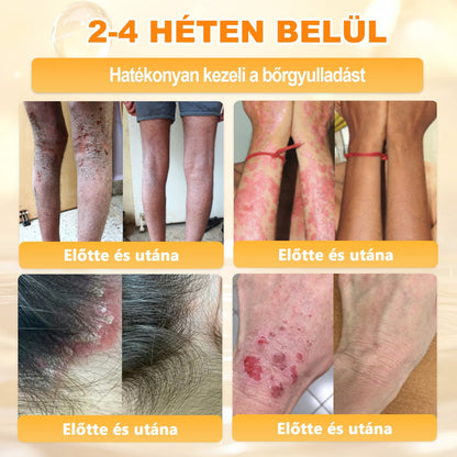 🔥 APKAPK® Méhméreg Bőr Helyreállító Krém 🔥 Magyar fejlesztés, magyarországi gyártás és szállítás