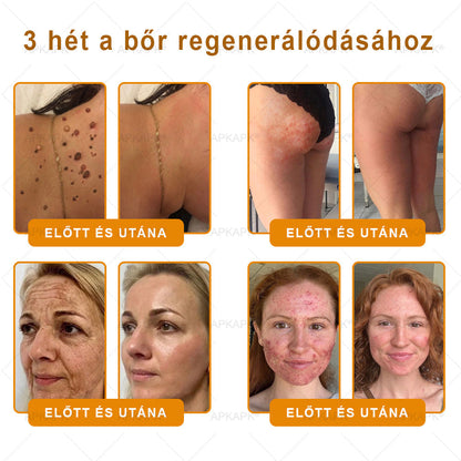 🔥 APKAPK® Méhméreg Bőr Helyreállító Krém 🔥 Magyar fejlesztés, magyarországi gyártás és szállítás