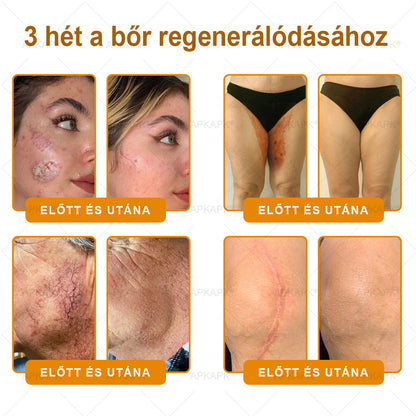 🔥 APKAPK® Méhméreg Bőr Helyreállító Krém 🔥 Magyar fejlesztés, magyarországi gyártás és szállítás