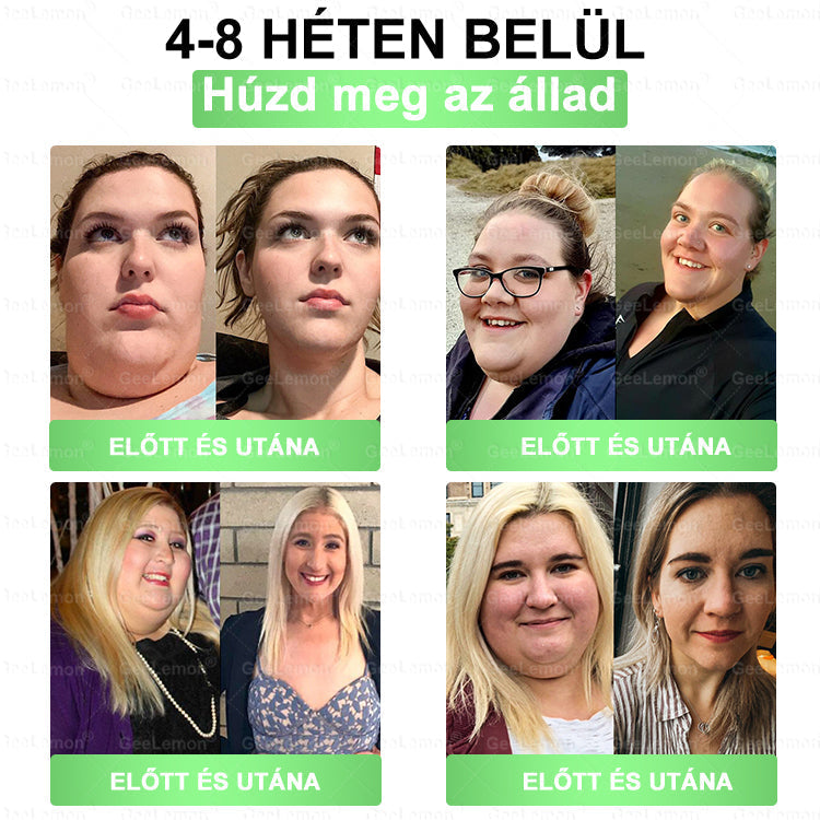 🎉| 🎁 𝐆𝐞𝑒𝐿𝑒𝐦𝐨𝐧® Nano mikrotűs karcsúsító tapasz (Naponta egyszer már 28 napon belül látható változások láthatók) Alkalmas: elhízás kezelésére, szív- és érrendszeri egészségre, cukorbetegség kezelésére, alvási apnoéra és bélrendszeri problémákra🔥