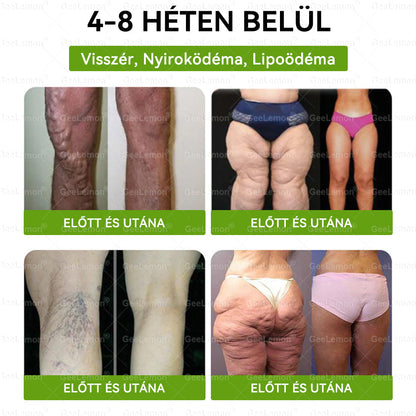 🎉| 🎁 𝐆𝐞𝑒𝐿𝑒𝐦𝐨𝐧® Nano mikrotűs karcsúsító tapasz (Naponta egyszer már 28 napon belül látható változások láthatók) Alkalmas: elhízás kezelésére, szív- és érrendszeri egészségre, cukorbetegség kezelésére, alvási apnoéra és bélrendszeri problémákra🔥