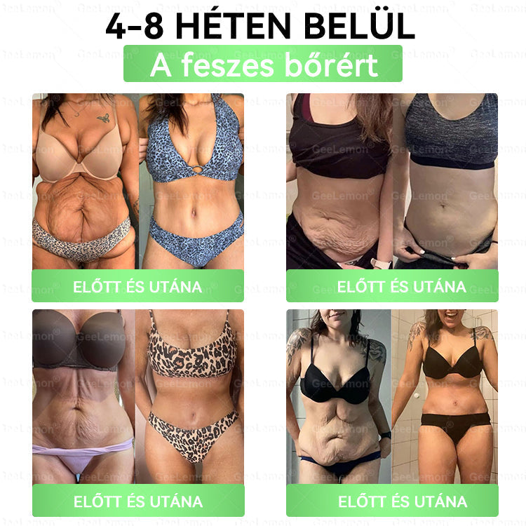 🎉| 🎁 𝐆𝐞𝑒𝐿𝑒𝐦𝐨𝐧® Nano mikrotűs karcsúsító tapasz (Naponta egyszer már 28 napon belül látható változások láthatók) Alkalmas: elhízás kezelésére, szív- és érrendszeri egészségre, cukorbetegség kezelésére, alvási apnoéra és bélrendszeri problémákra🔥